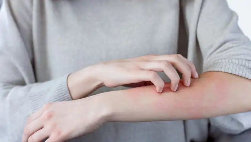 Cilt Kanserine Dikkat: Dermatologdan Gözden Kaçan İki Belirti Açıklaması