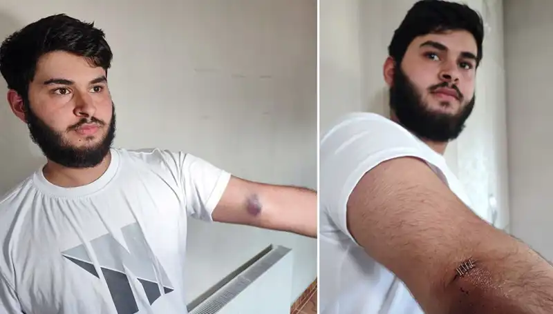 Bahçeye Kaçan Top, Mahallede Şaşkınlığa Neden Oldu!